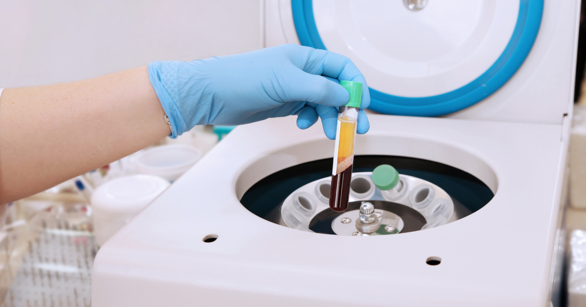 Blood sample being prepared in a centrifuge for PRP therapy in Las Vegas and platelet rich plasma treatment for joint pain recovery.