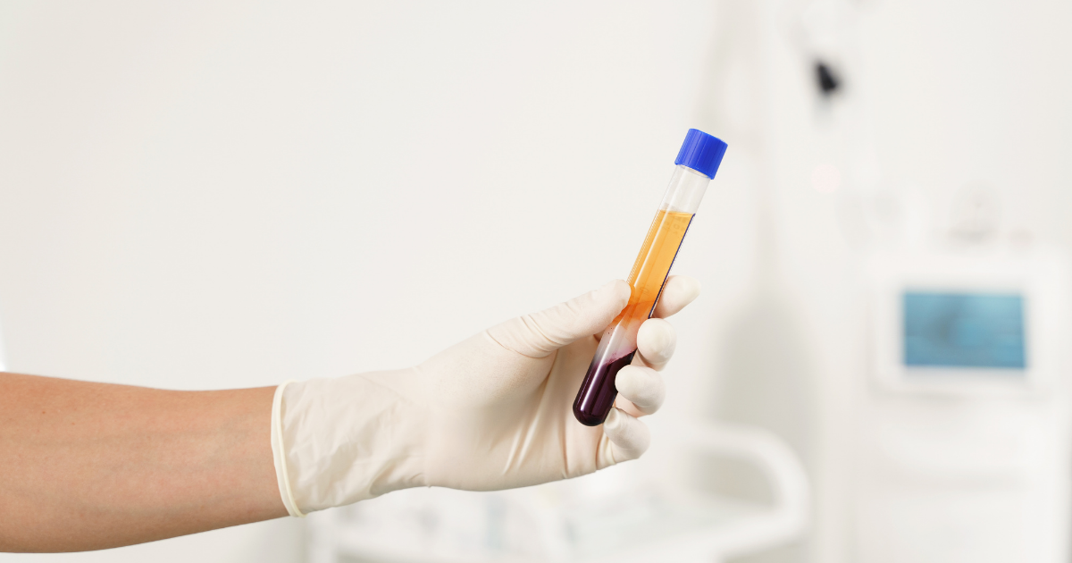 Gloved medical professional holding a centrifuged blood for PRP vs Stem Cell Therapy sample with separated plasma for platelet rich plasma therapy in Las Vegas